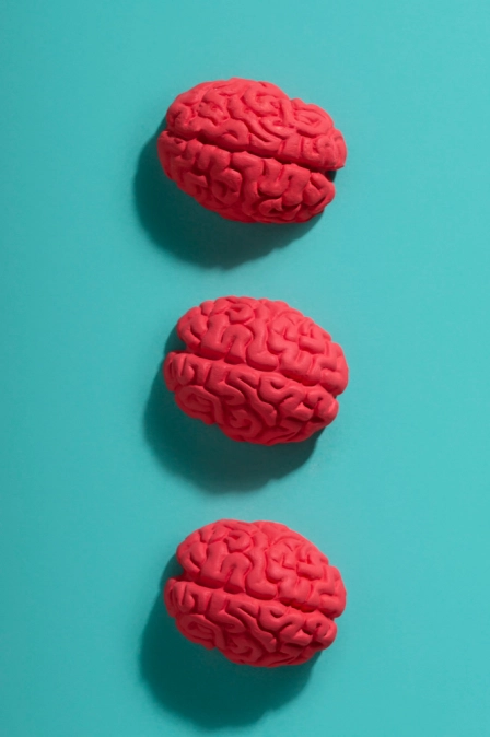 фото мозга при дисциркуляторной энцефалопатии